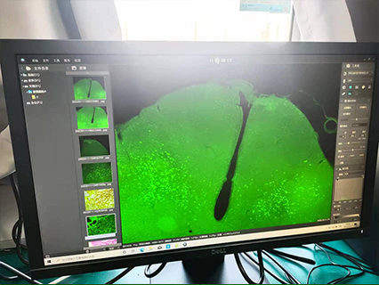 奧林巴斯顯微鏡 奧林巴斯顯微鏡