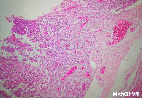 明美顯微鏡相機(jī)