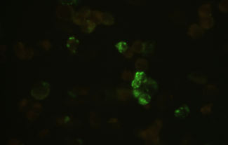 上呼吸道病毒(藍(lán)色激發(fā))