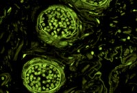 �{(l��n)ɫ�ɹ�ģ�K�Ĕz�ğɹ��@΢�DƬ